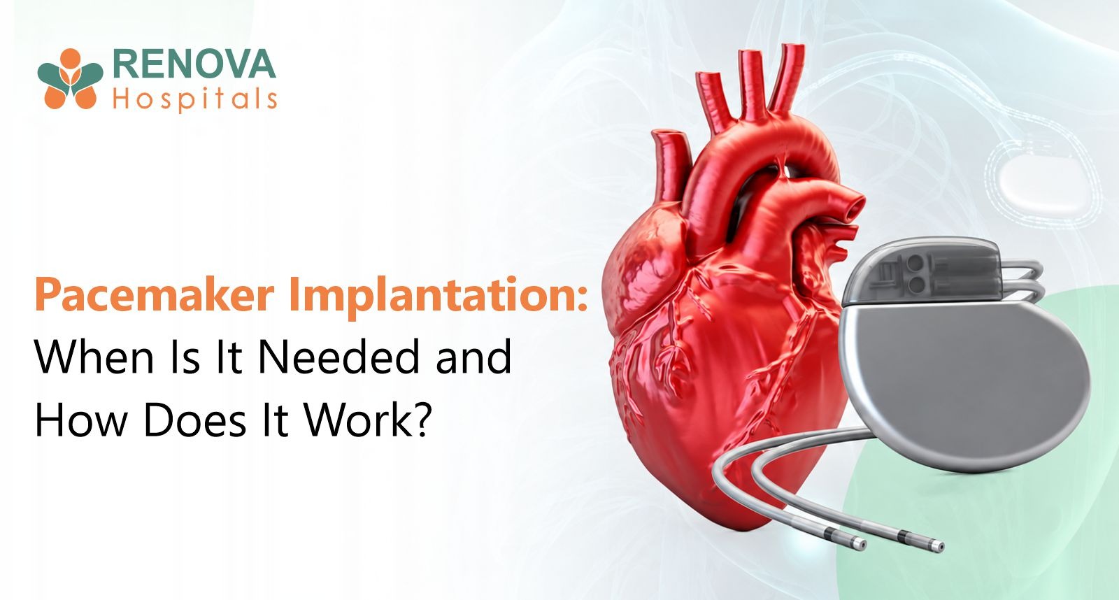When is a pacemaker needed? Understanding pacemaker implantation