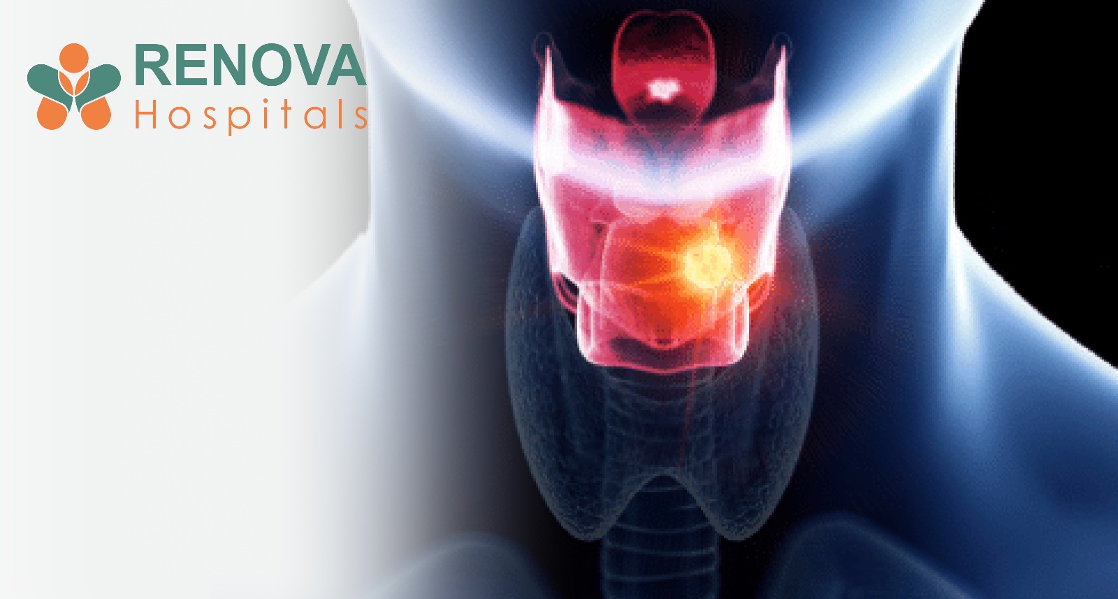 Chronic Hoarseness Treatment at Renova Hospitals
