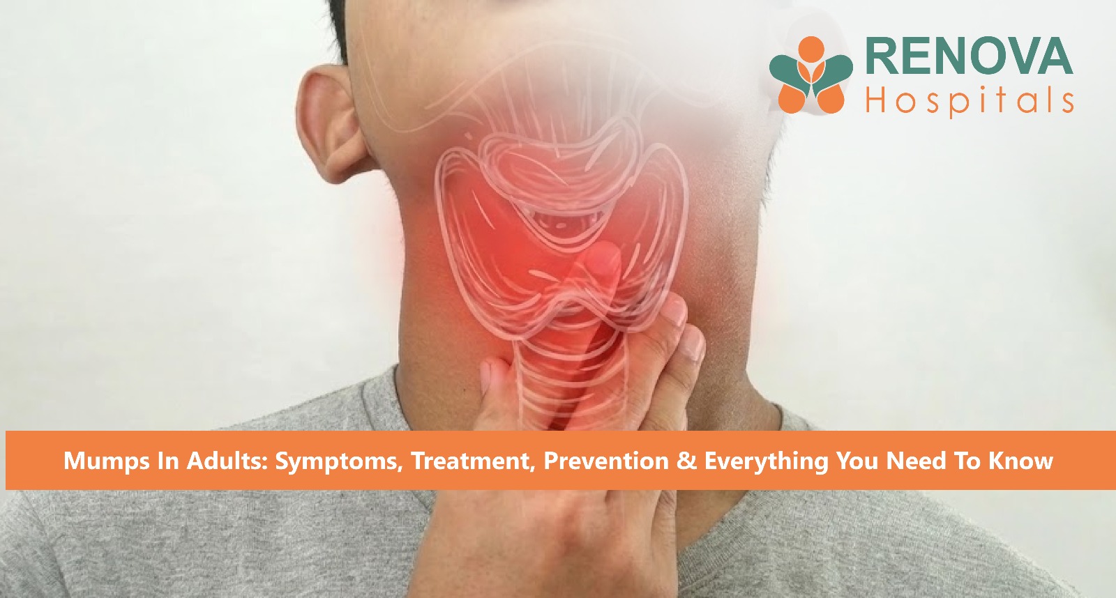 Mumps Causes Painful Swelling of the Salivary Glands Near the Jaw