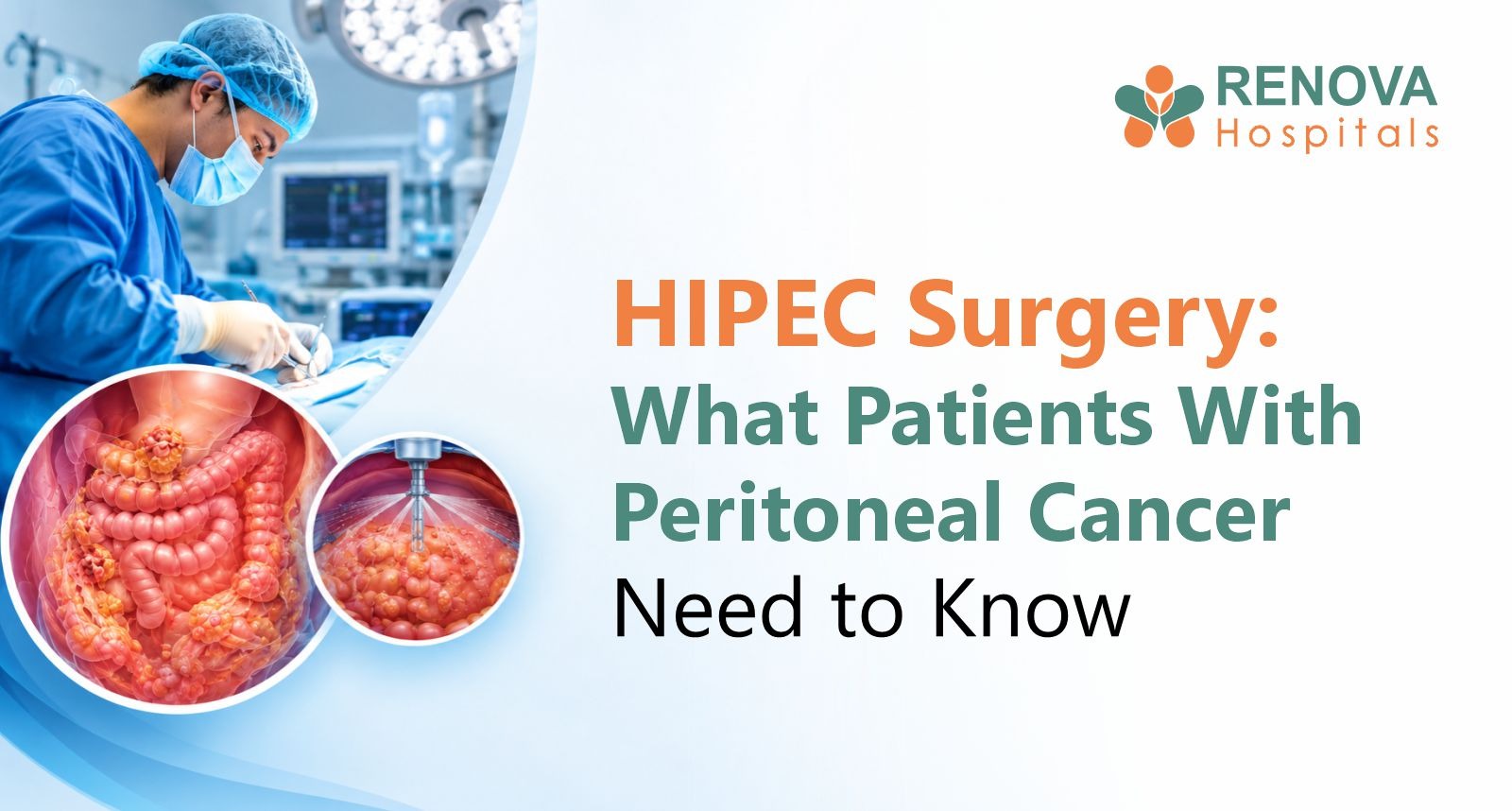 Understanding HIPEC surgery for peritoneal cancer treatment