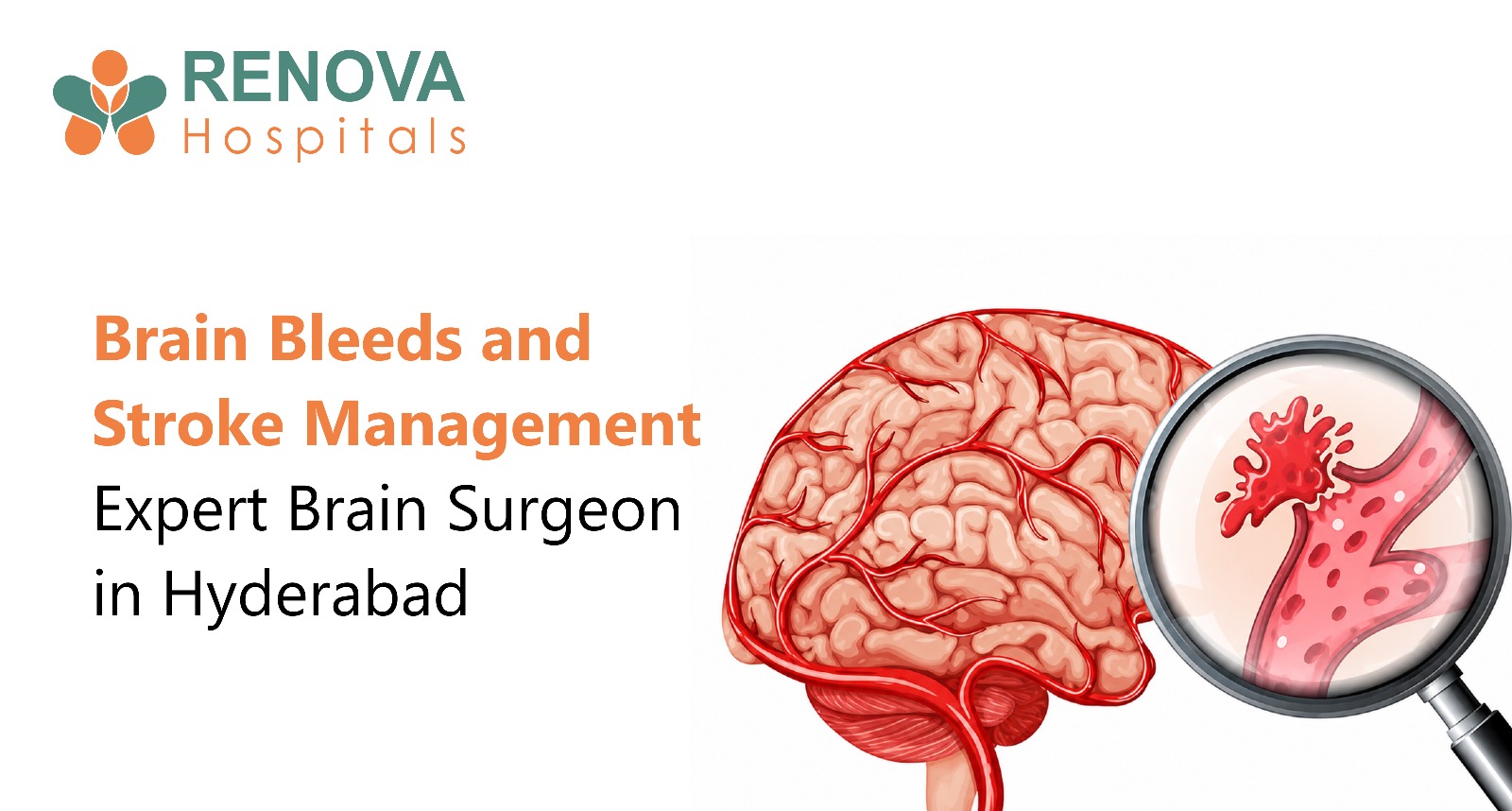 Recognizing Stroke Symptoms Early Can Save Lives and Protect Brain Function