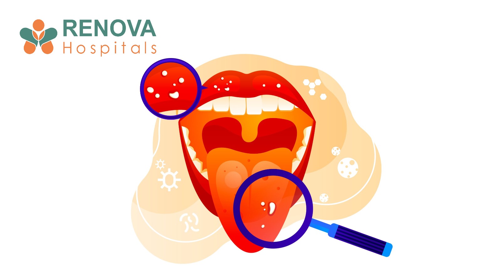 Oral Cancer in India: Causes, Early Signs, and Survival Rates