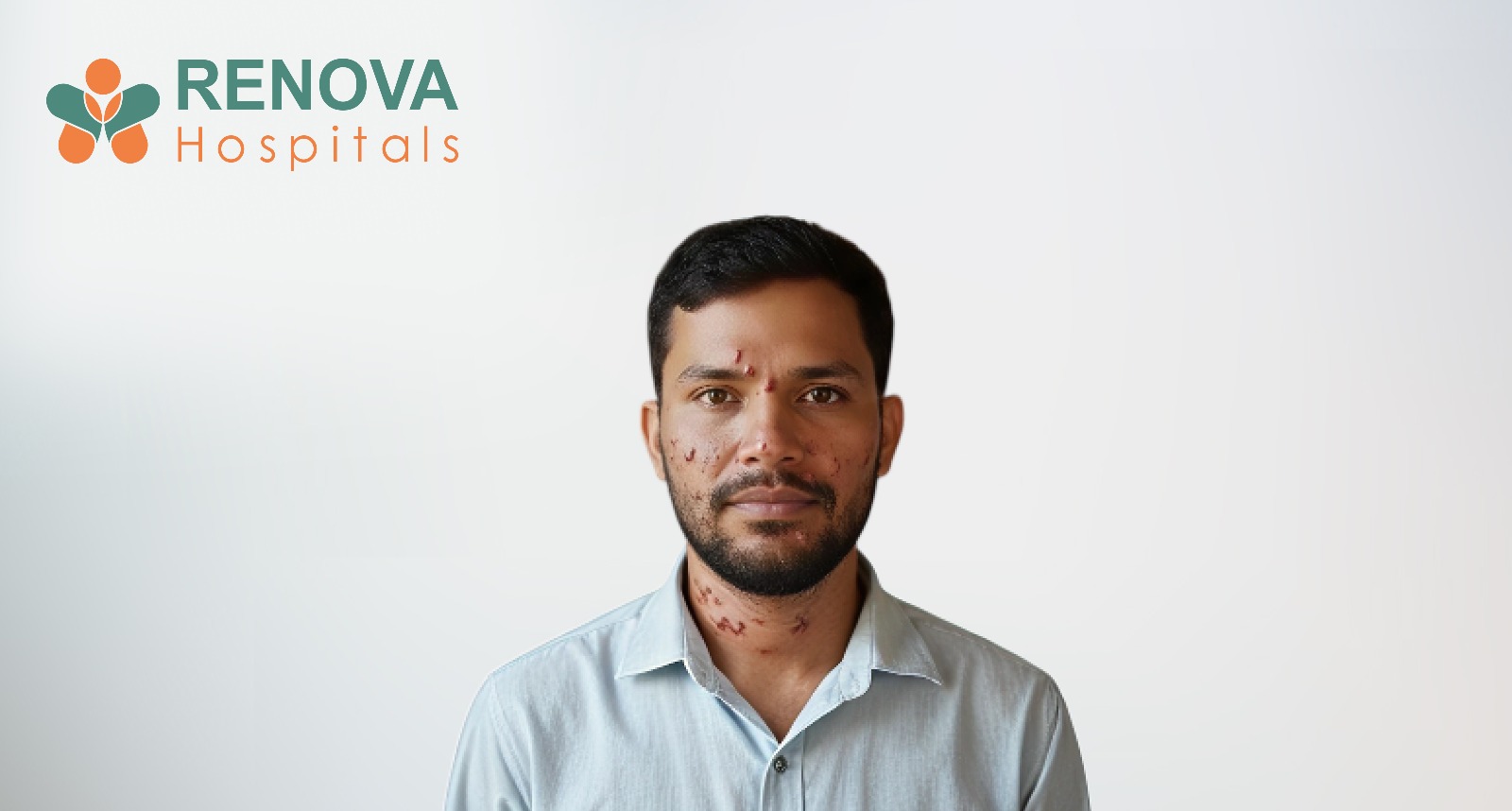 Yaws Disease Treatment at Renova Hospitals