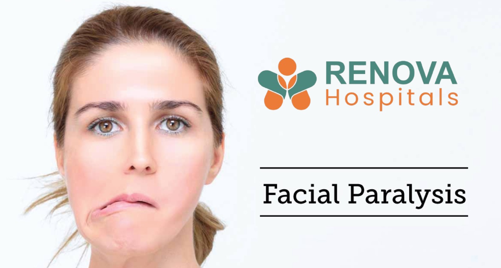 Facial Paralysis Treatment at Renova Hospitals