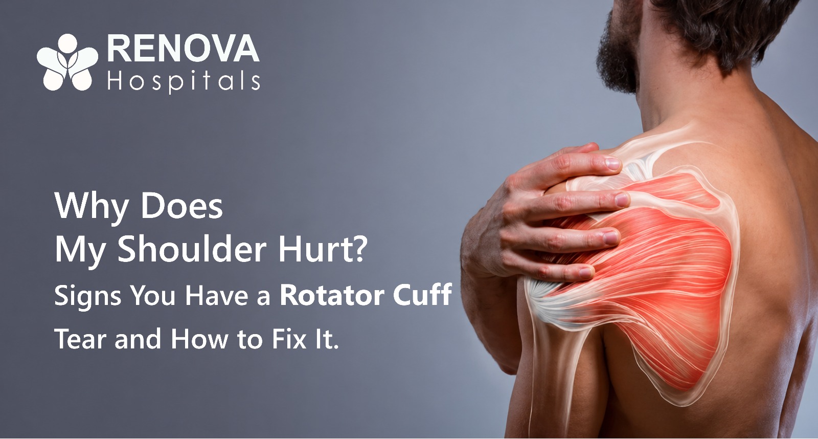 Rotator Cuff Tears Are a Common Cause of Shoulder Pain and Weakness