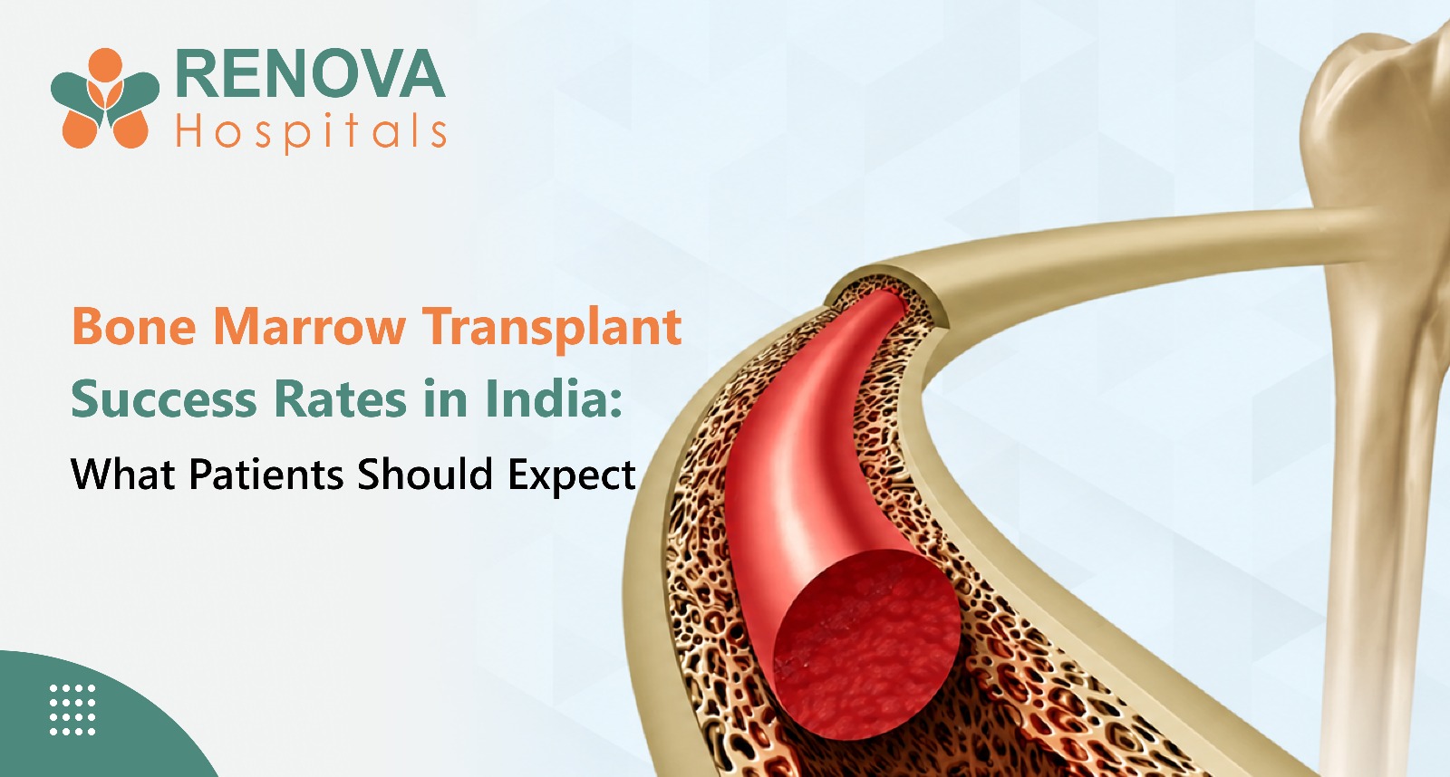 Bone Marrow Transplant Can Offer Long-Term Remission and Cure for Selected Blood Disorders