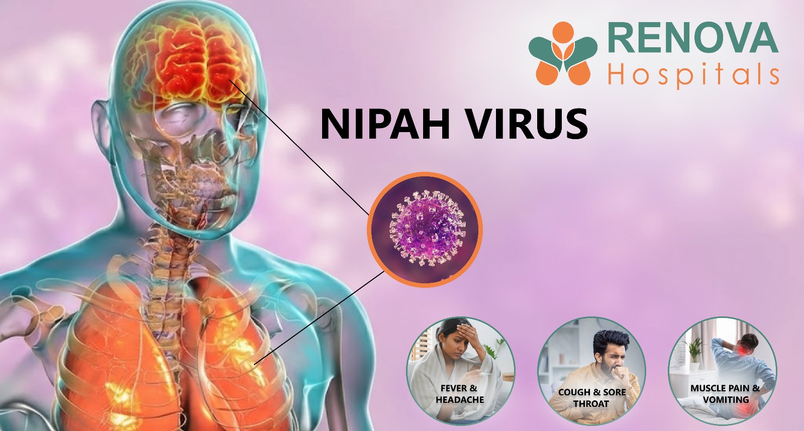 Nipah Virus: Symptoms, Causes, Transmission, Treatment & Prevention