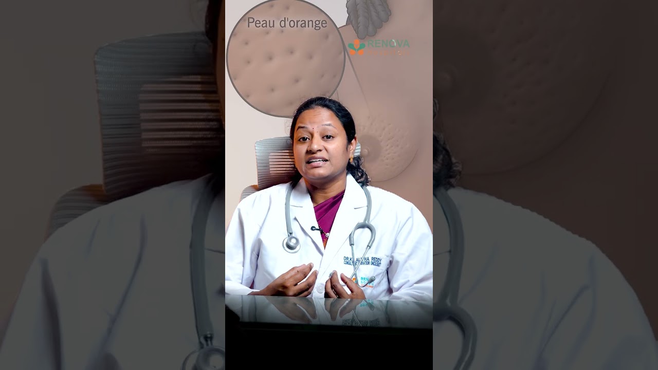 Breast Cancer ముందే గుర్తించడం ఎలా?| Dr.Lalitha Reddy Top Radiation Oncologist | RenovaHospitals