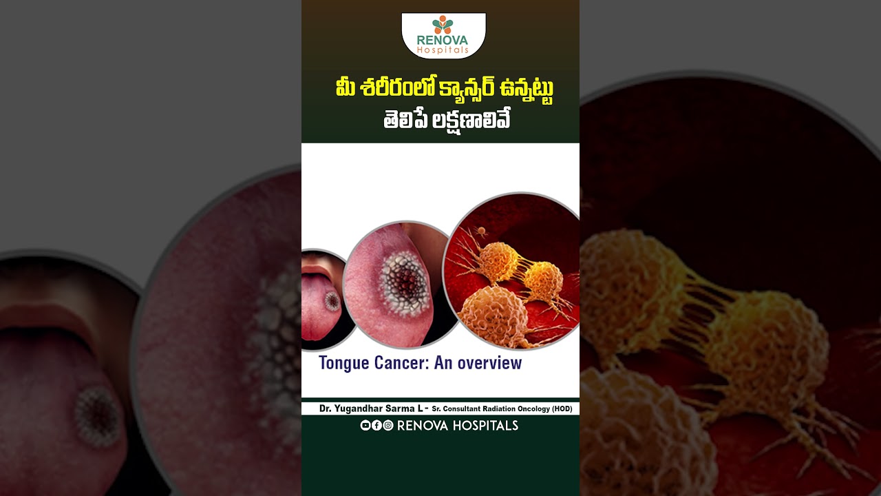 Throat Cancer Symptoms Telugu | Best Cancer Hospital Hyderabad | Renova Hospitals