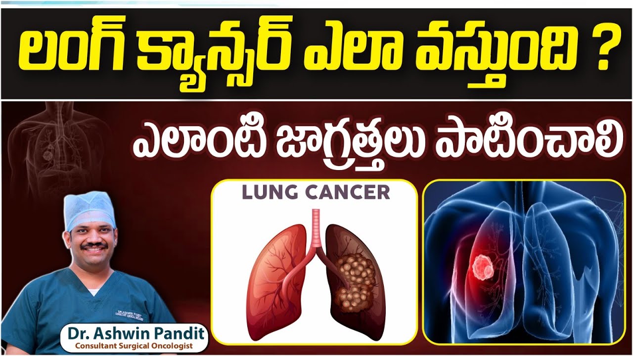 లంగ్ క్యాన్సర్ లక్షణాలు | Causes and Symptoms Lung Cancer in Telugu | Lung Cancer Treatment | Renova