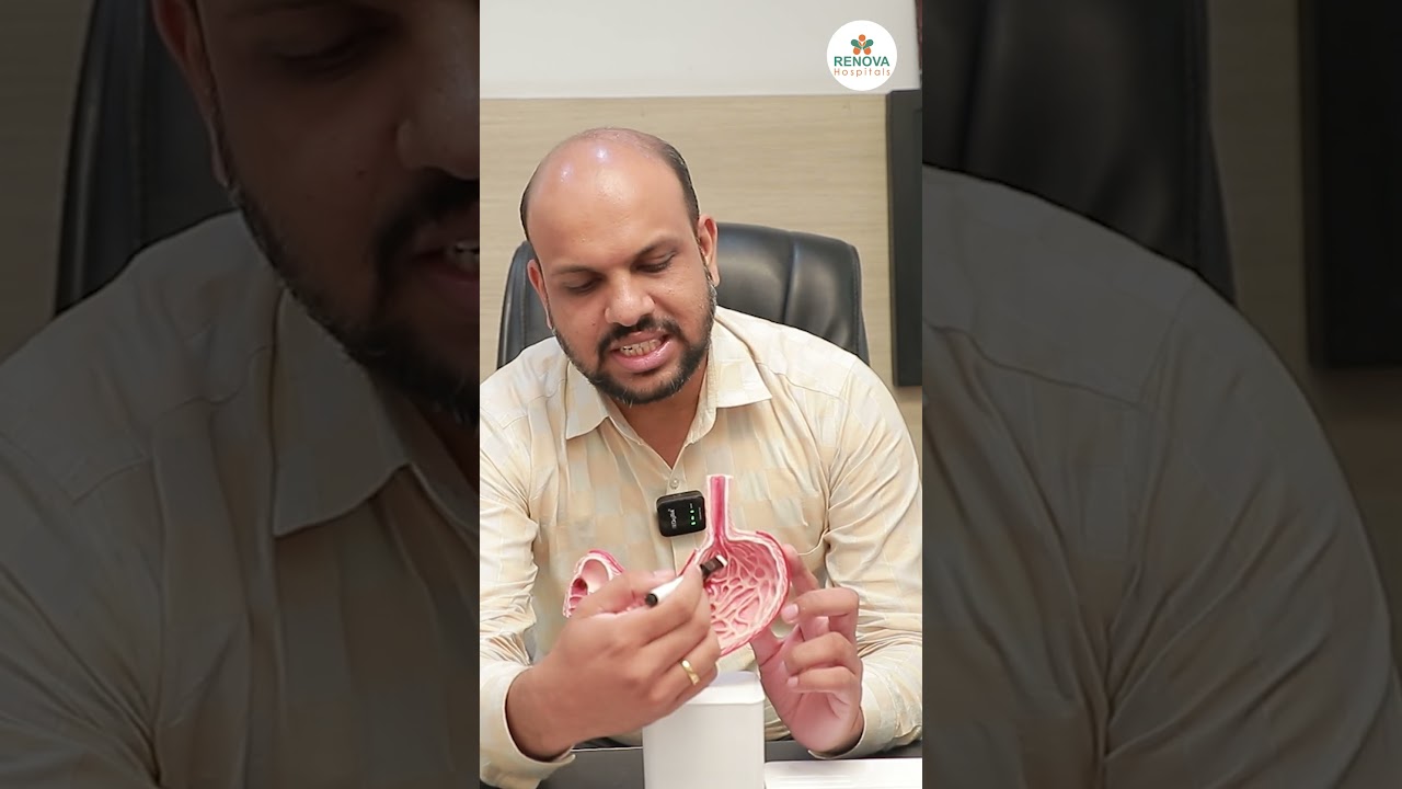 What Is The Cause Of Ulcers In The Stomach | Renova #shorts #ulcers #yt